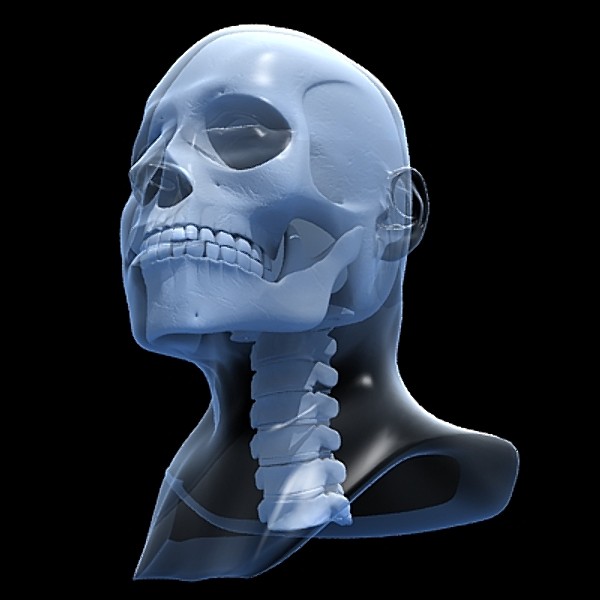 skull cervical spine 3d max - Skull and cervical spine by RadioMatrix