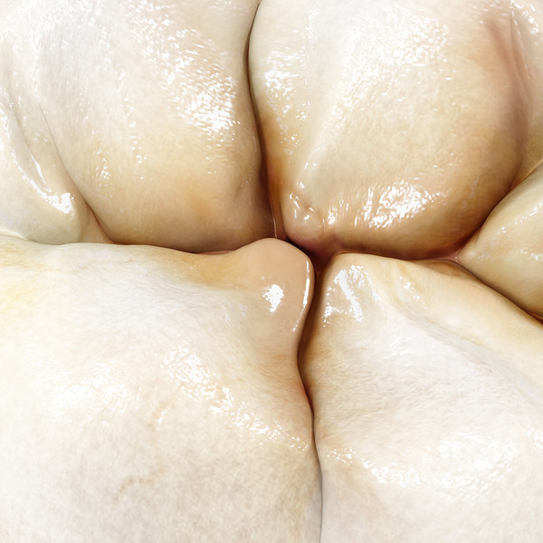 max v4 0 molars - 1st Right Permanent Molars v4.0 by Nikola Dechev