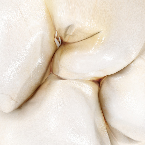 max v4 0 molars - 1st Right Permanent Molars v4.0 by Nikola Dechev