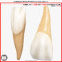 3d v4 0 incisors model