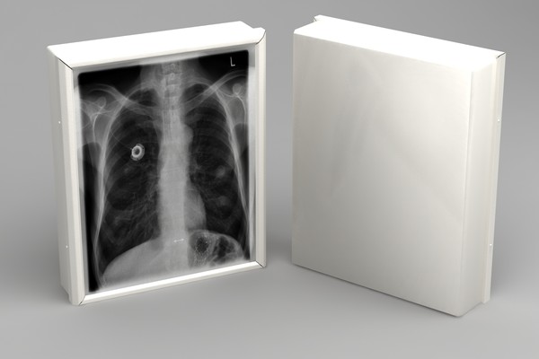 3d x-ray negatoskop - negatoskop by dentonvanzan