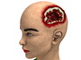 obj bust girl severe head