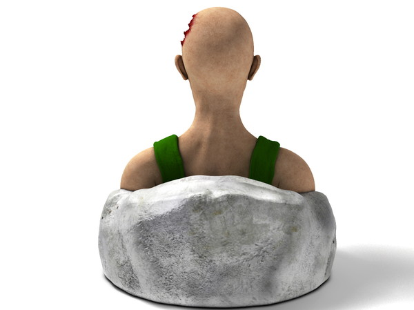 obj bust girl severe head - Girl with severe Head Injury... by scyrus