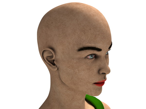 obj bust girl severe head - Girl with severe Head Injury... by scyrus