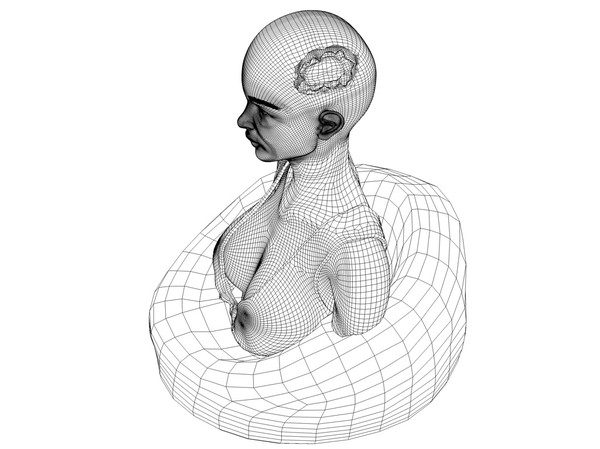 obj bust girl severe head - Girl with severe Head Injury... by scyrus