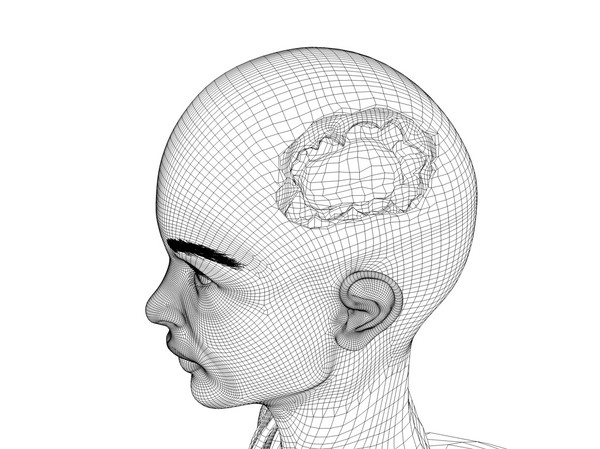 obj bust girl severe head - Girl with severe Head Injury... by scyrus