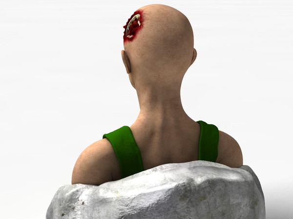 obj bust girl severe head - Girl with severe Head Injury... by scyrus