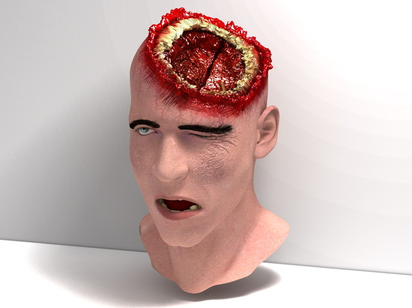 3d head joint - Man with severe Headwound or Headshot by scyrus