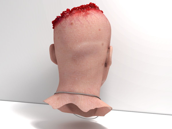 3d head joint - Man with severe Headwound or Headshot by scyrus