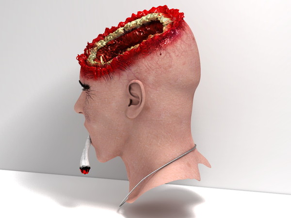 3d head joint - Man with severe Headwound or Headshot by scyrus