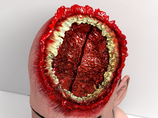 3d head joint - Man with severe Headwound or Headshot by scyrus