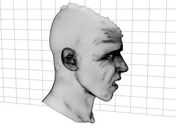 3d head joint - Man with severe Headwound or Headshot by scyrus