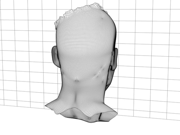 3d head joint - Man with severe Headwound or Headshot by scyrus