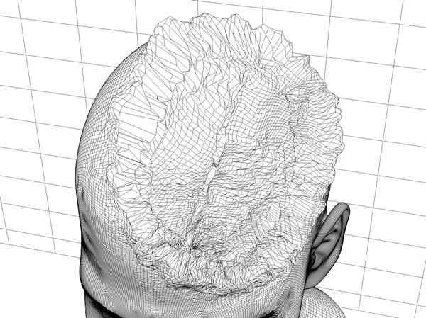3d head joint - Man with severe Headwound or Headshot by scyrus