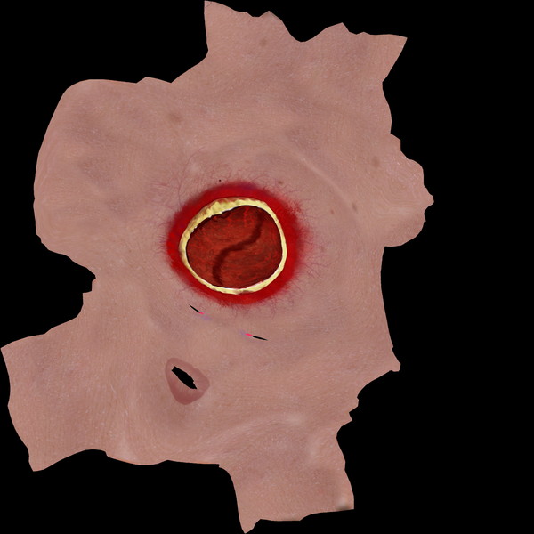 3d head joint - Man with severe Headwound or Headshot by scyrus