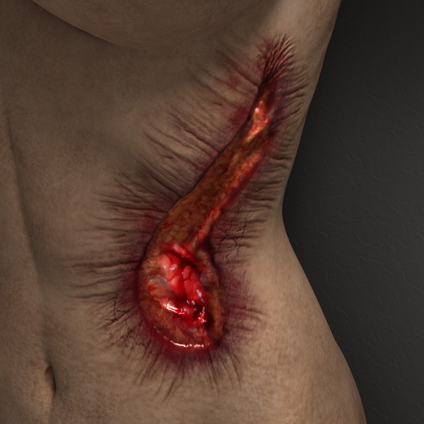 mutilated female corpse 3d model - Mutilated Corpse Body Female... by scyrus