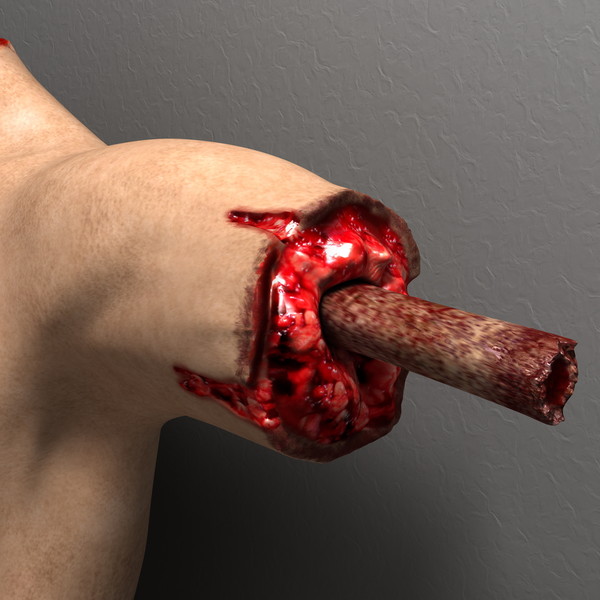mutilated female corpse 3d model - Mutilated Corpse Body Female... by scyrus