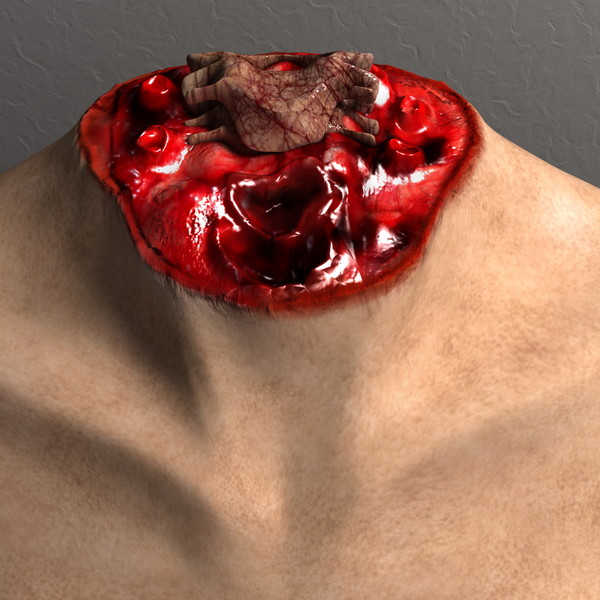 mutilated female corpse 3d model - Mutilated Corpse Body Female... by scyrus