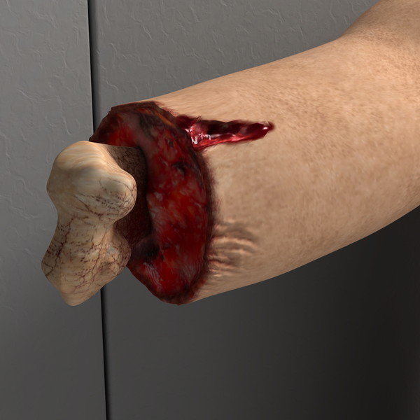 mutilated female corpse 3d model - Mutilated Corpse Body Female... by scyrus