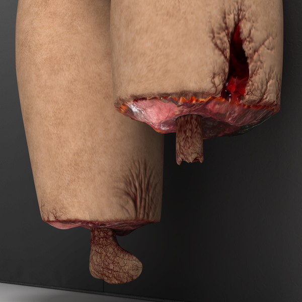 mutilated female corpse 3d model - Mutilated Corpse Body Female... by scyrus