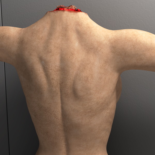 mutilated female corpse 3d model - Mutilated Corpse Body Female... by scyrus