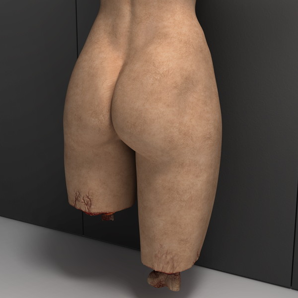 mutilated female corpse 3d model - Mutilated Corpse Body Female... by scyrus