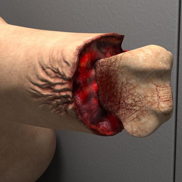 mutilated female corpse 3d model - Mutilated Corpse Body Female... by scyrus