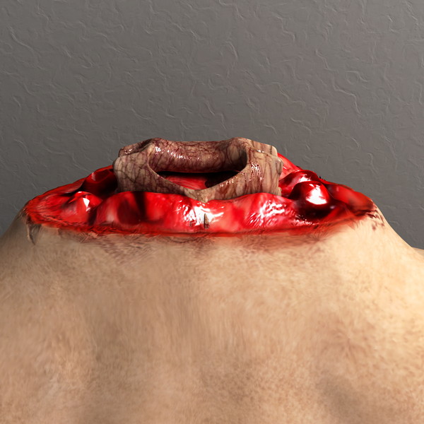 mutilated female corpse 3d model - Mutilated Corpse Body Female... by scyrus