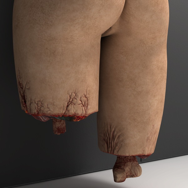mutilated female corpse 3d model - Mutilated Corpse Body Female... by scyrus