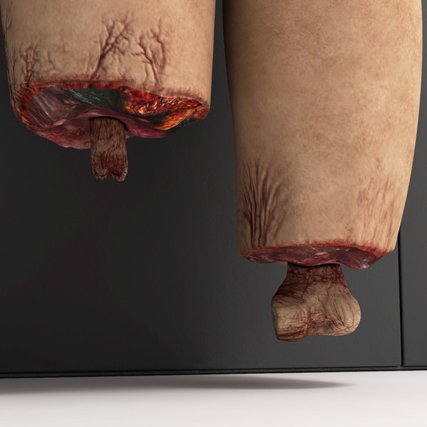 mutilated female corpse 3d model - Mutilated Corpse Body Female... by scyrus