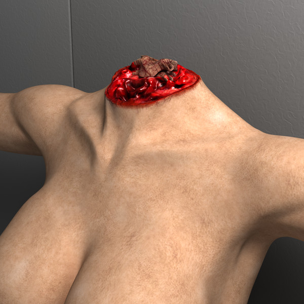 mutilated female corpse 3d model - Mutilated Corpse Body Female... by scyrus