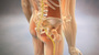 Sciatic nerve pain with skeleton stock