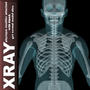 x-ray human 3d model