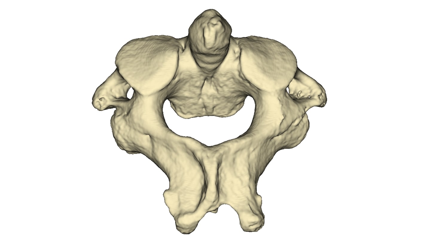 3ds max human vertebra c2 axis