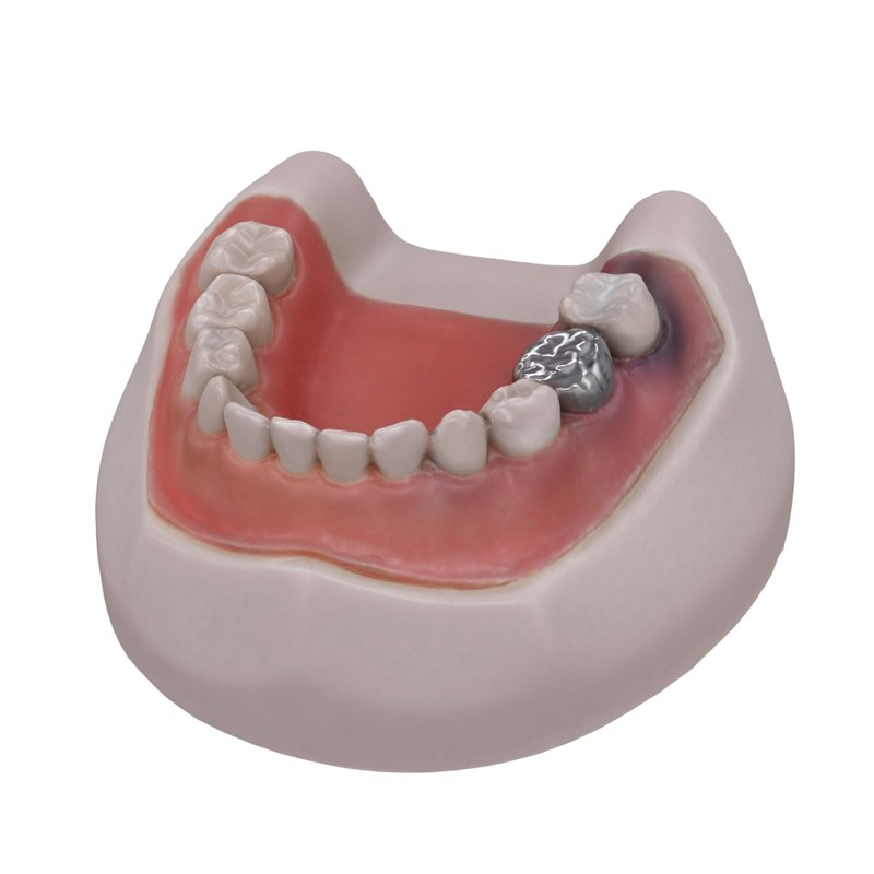 3d typodont harvard dental