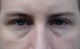 Stare Eyes