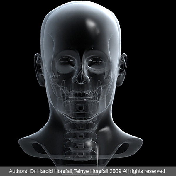 skull cervical spine 3d max - Skull and cervical spine by RadioMatrix