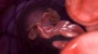 Red Blood Cells Travel Through Blood Vessel